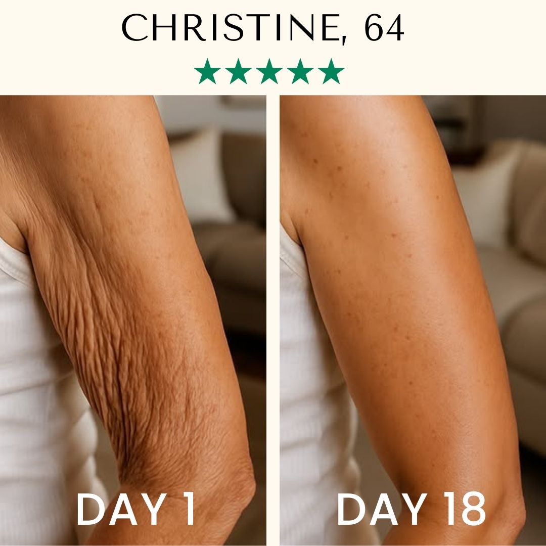 Lifting Body Oil: Crepey skin? Fine lines? It’s time to glow again.