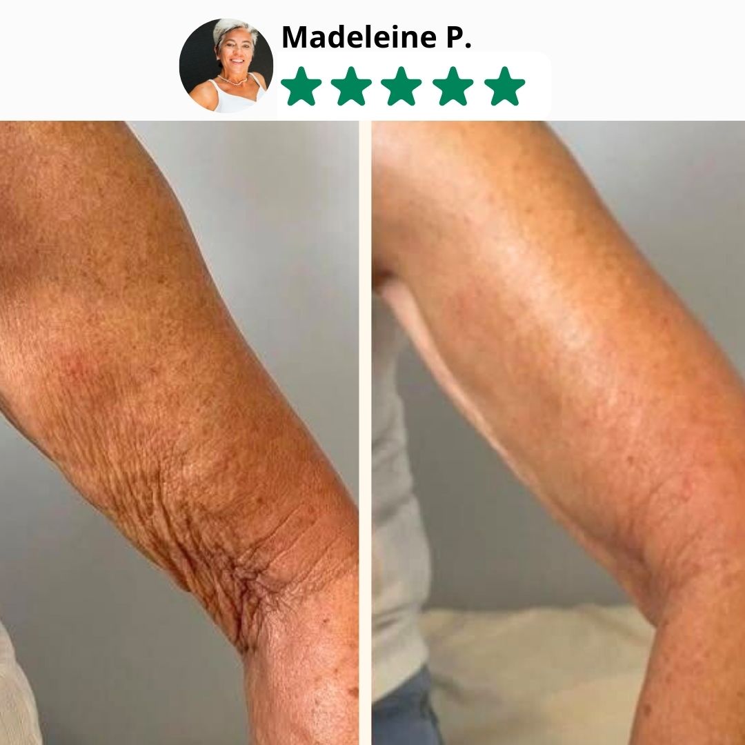 Lifting Body Oil: Crepey skin? Fine lines? It’s time to glow again.